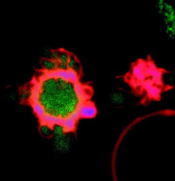 Apoptosis Implication in Cardiovascular Disease